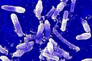 Bacillus cereus (Foto: Frederick C. Michel, ASM MicrobeLibrary)